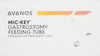 Avanos 8140-14-0.8 Mic-Key Gastrostomy Feeding Tube 14Fr x 0.8cm