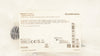 Smith&Nephew 72200906 Clear-Trac Complete Cannula System 7.0mm x72mm Smooth (x)