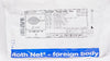 US Endoscopy 00711057 Roth Net-Foreign Body Pediatric 160cm x 2.0cm x 1.8mm (x)