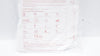BD 2477-0007 Alaris Pump Infusion Blood Set 180 Micron Filter 15Drops/ml