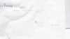 Ethicon B12XT Endopath XCEL Bladeless Trocar W/ Stability Sleeve 12mm x 150mm